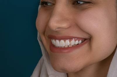In-home mobile teeth whitening session by Carte Blanche in Los Angeles